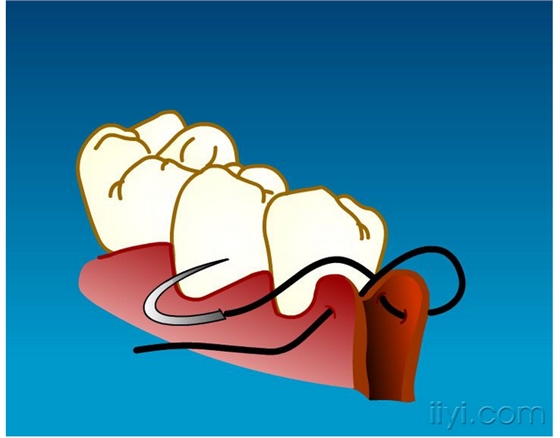 QQ圖片20150729105006.png QQ圖片20150729105006.png