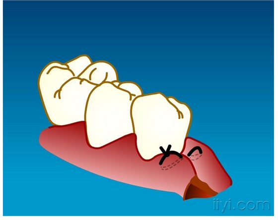 QQ圖片20150729105018.png QQ圖片20150729105018.png