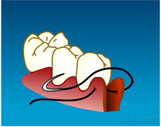 QQ圖片20150729105042.png QQ圖片20150729105042.png