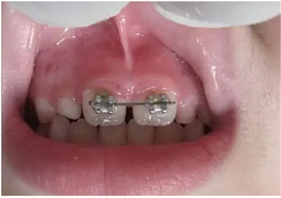 QQ圖片20150730090030.png QQ圖片20150730090030.png