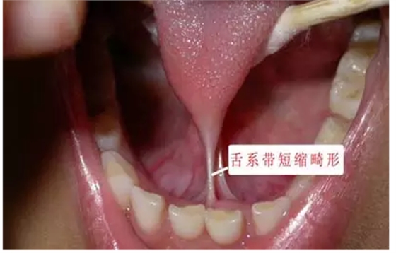 QQ圖片20150730090043.png QQ圖片20150730090043.png