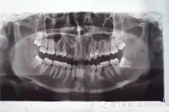 QQ圖片20150730094928.png QQ圖片20150730094928.png