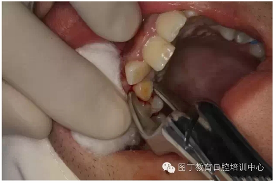 QQ圖片20150730095006.png QQ圖片20150730095006.png