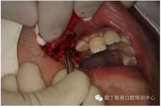 QQ圖片20150730095038.png QQ圖片20150730095038.png