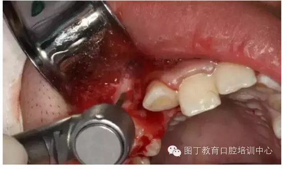 QQ圖片20150730095115.png QQ圖片20150730095115.png