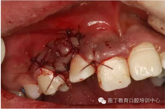 QQ圖片20150730095307.png QQ圖片20150730095307.png