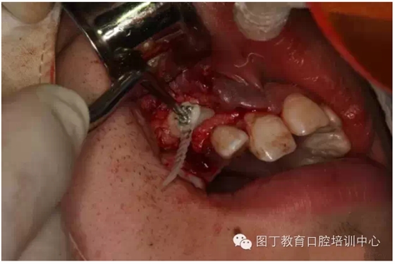 QQ圖片20150730095232.png QQ圖片20150730095232.png