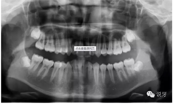 QQ圖片20150730111049.png QQ圖片20150730111049.png