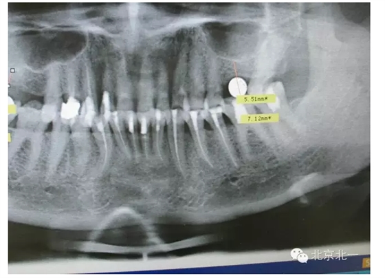 QQ圖片20150803111245.png QQ圖片20150803111245.png