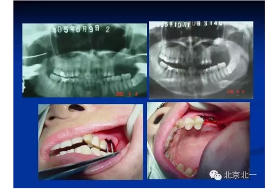 QQ圖片20150803112106.png QQ圖片20150803112106.png