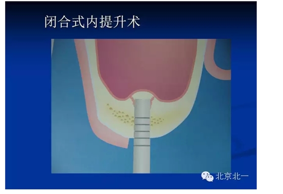 QQ圖片20150803112424.png QQ圖片20150803112424.png