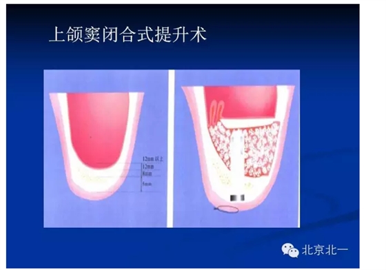 QQ圖片20150803112541.png QQ圖片20150803112541.png