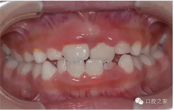 QQ圖片20150803104838.png QQ圖片20150803104838.png