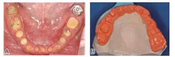 QQ圖片20150803123211.png QQ圖片20150803123211.png