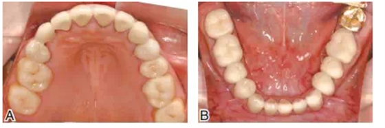 QQ圖片20150803123256.png QQ圖片20150803123256.png