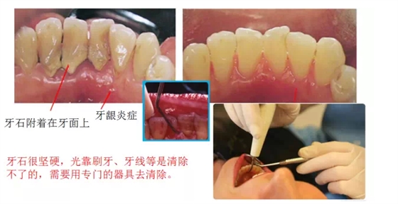 QQ圖片20150803132322.png QQ圖片20150803132322.png