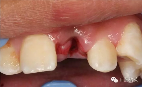 QQ圖片20150804105459.png QQ圖片20150804105459.png