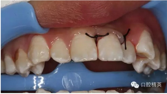 QQ圖片20150804110740.png QQ圖片20150804110740.png