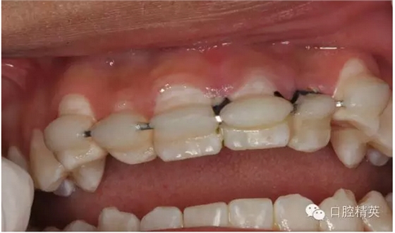 QQ圖片20150804110937.png QQ圖片20150804110937.png