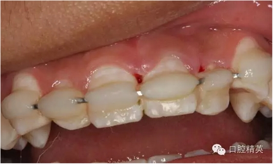 QQ圖片20150804111006.png QQ圖片20150804111006.png