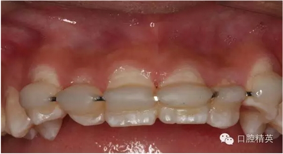 QQ圖片20150804111058.png QQ圖片20150804111058.png