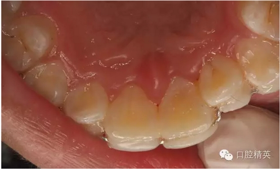 QQ圖片20150804111113.png QQ圖片20150804111113.png