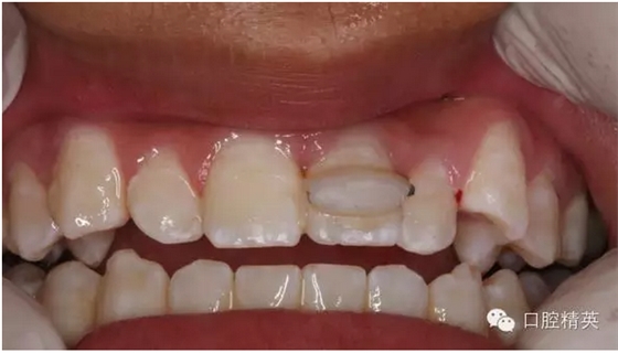 QQ圖片20150804111158.png QQ圖片20150804111158.png