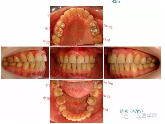 QQ圖片20150804151548.png QQ圖片20150804151548.png