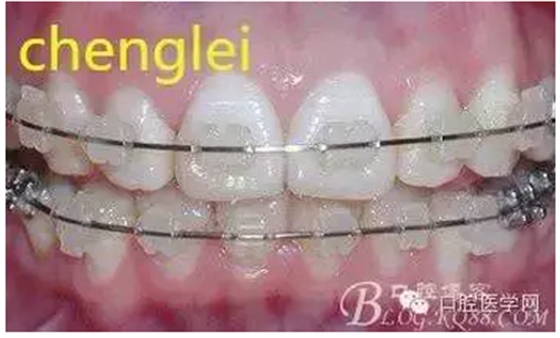 QQ圖片20150808171146.png QQ圖片20150808171146.png