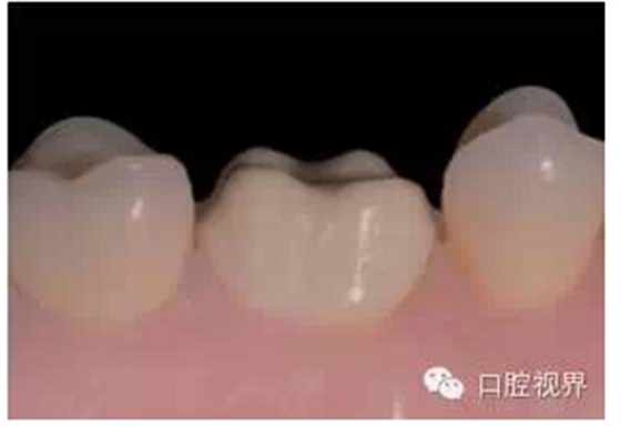 QQ圖片20150810092351.png QQ圖片20150810092351.png