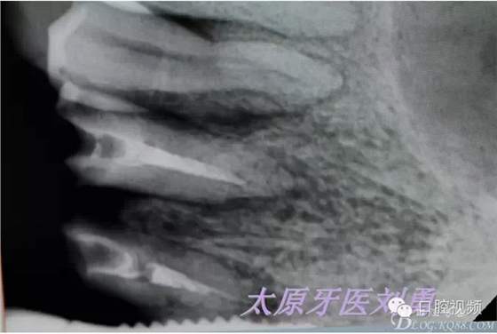 QQ圖片20150811100318.png QQ圖片20150811100318.png