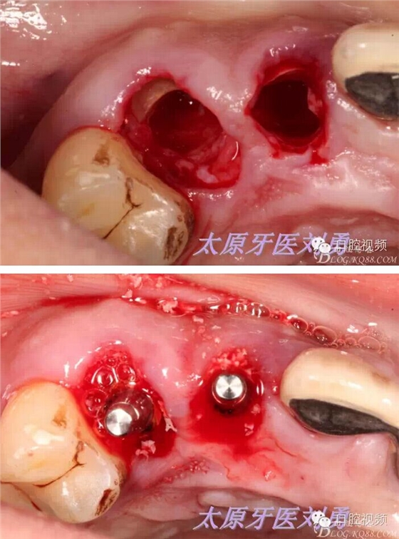 QQ圖片20150811100332.jpg QQ圖片20150811100332.jpg