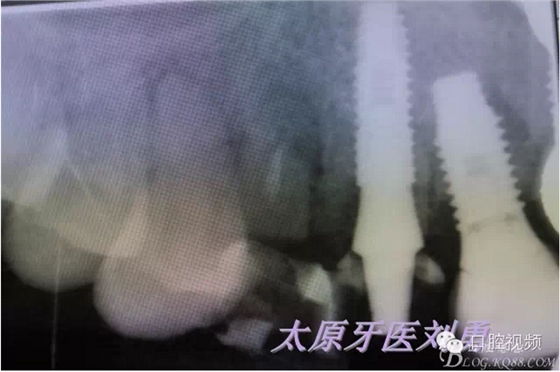 QQ圖片20150811100423.png QQ圖片20150811100423.png