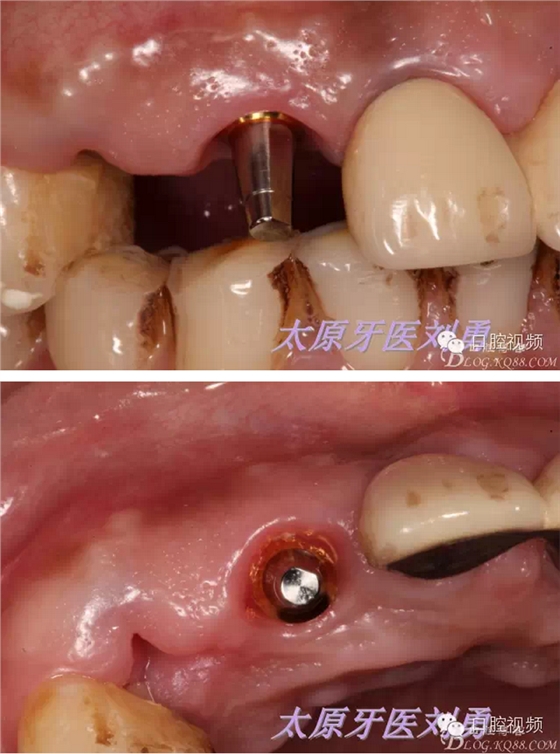 QQ圖片20150811100443.png QQ圖片20150811100443.png