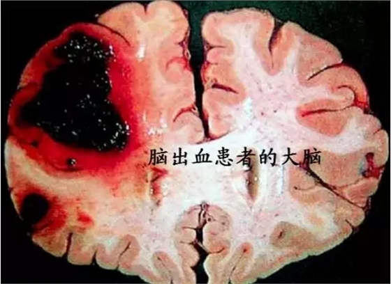 QQ圖片20150812090533.png QQ圖片20150812090533.png