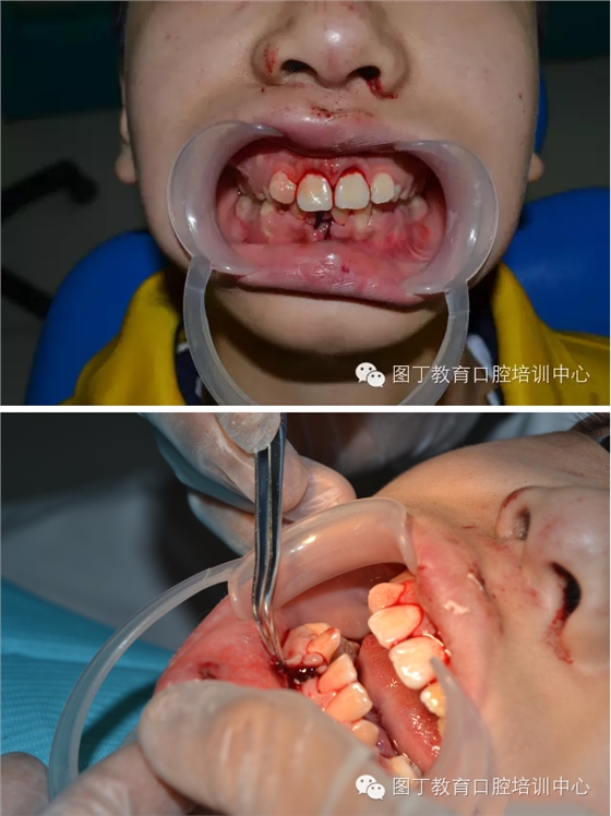 QQ圖片20150813150300.png QQ圖片20150813150300.png