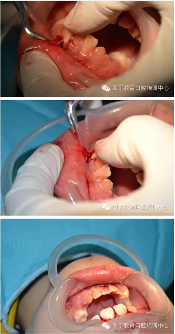 QQ圖片20150813150442.png QQ圖片20150813150442.png