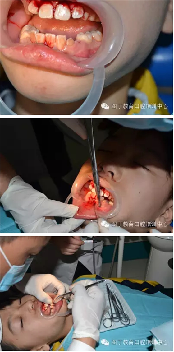 QQ圖片20150813150457.png QQ圖片20150813150457.png