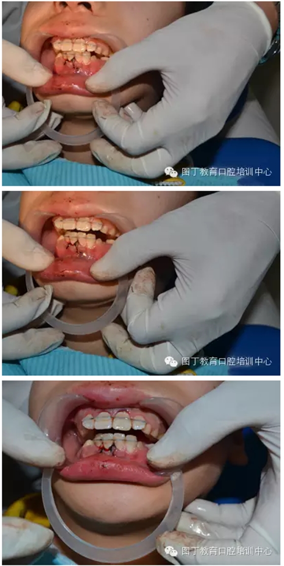 QQ圖片20150813150510.png QQ圖片20150813150510.png