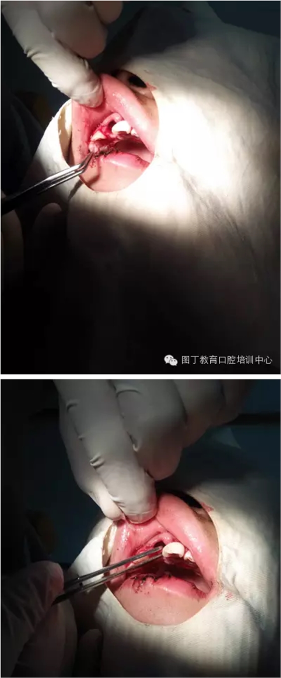 QQ圖片20150813150743.png QQ圖片20150813150743.png