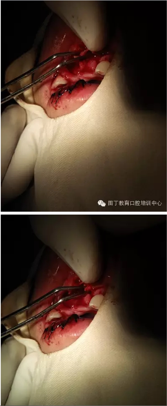 QQ圖片20150813150834.png QQ圖片20150813150834.png