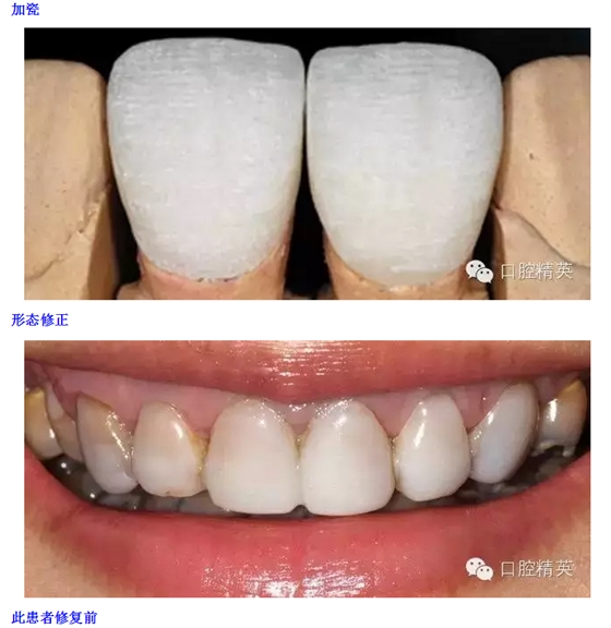 QQ圖片20150816095938.png QQ圖片20150816095938.png