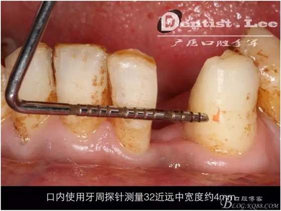 QQ圖片20150818092215.png QQ圖片20150818092215.png