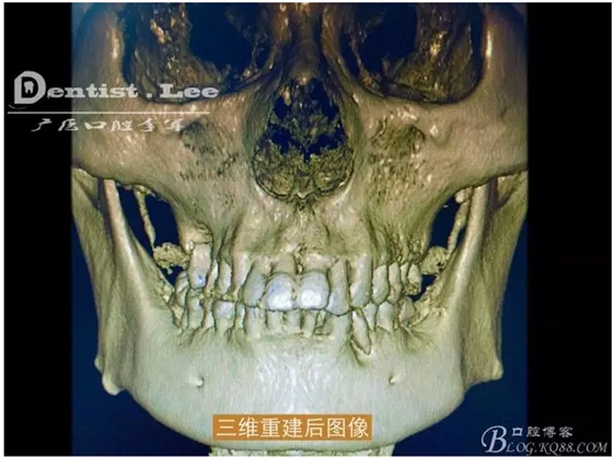 QQ圖片20150818092242.png QQ圖片20150818092242.png