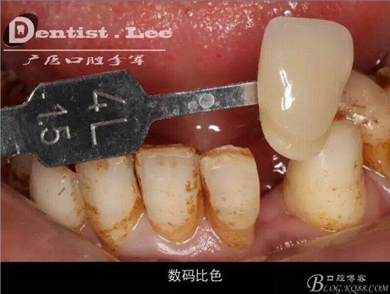 QQ圖片20150818092453.jpg QQ圖片20150818092453.jpg