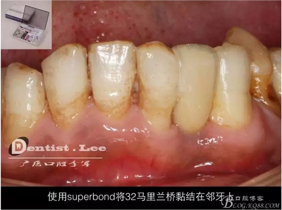 QQ圖片20150818092519.png QQ圖片20150818092519.png