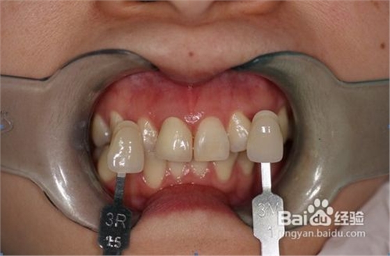 QQ圖片20150818101811.png QQ圖片20150818101811.png