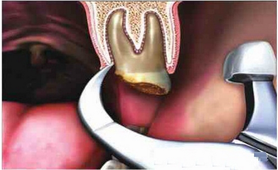 QQ圖片20150819142320.png QQ圖片20150819142320.png