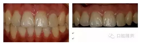 QQ圖片20150821093125.png QQ圖片20150821093125.png