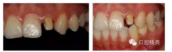 QQ圖片20150821093140.png QQ圖片20150821093140.png